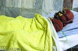 سالانه ۲۵ هزار ایرانی می سوزند/وضعیت تخت های سوختگی در کشور
